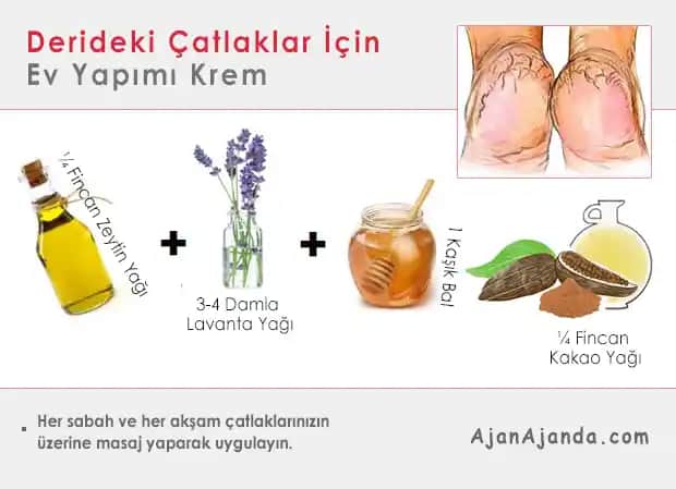 Çatlaklara Karşı Doğal ve Klinik Yöntemler: Cilt Sağlığını Korumanın En Etkili Yolları