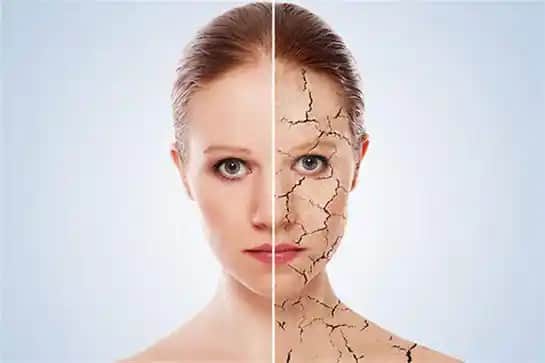 Cilt Kabuklanmasına Karşı Etkili Doğal ve Bilinçli Bakım Yöntemleri