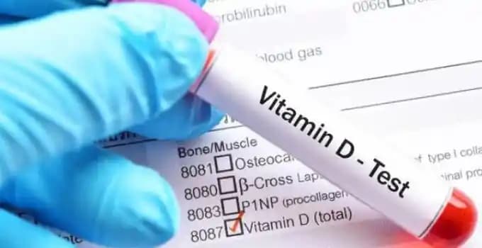 D vitamini testi fiyatları ve sağlıklı yaşam için önemi hakkında kapsamlı bilgi