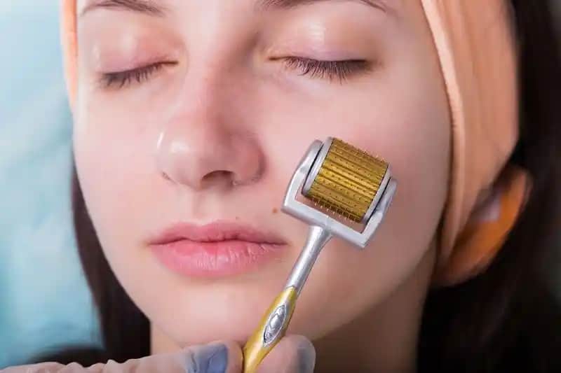 Dermaroller ile Doğal Cilt Yenileme Yöntemleri ve Faydaları Hakkında Bilgi