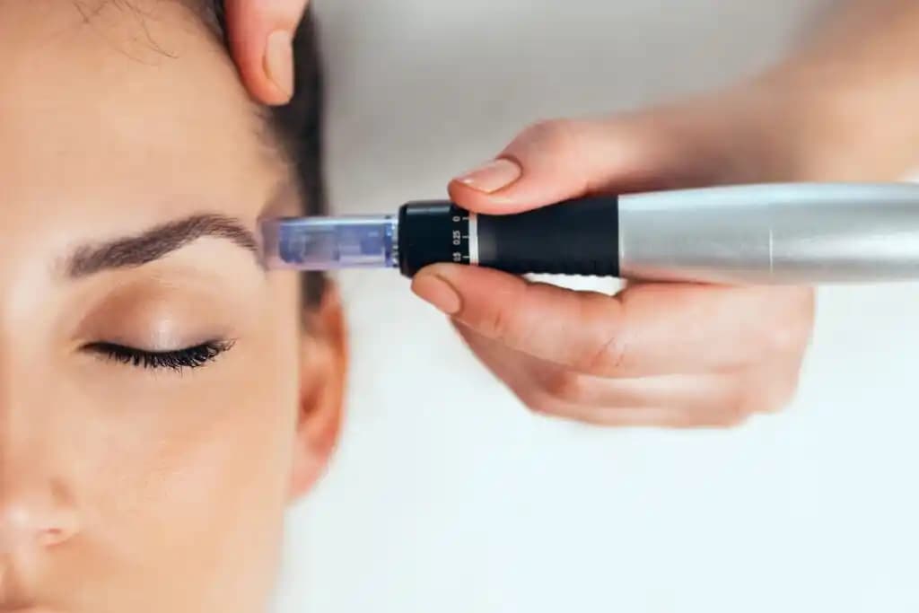 Dermaroller Sonrası Cilt Bakımı: Uygun Ürünler ve Doğru Uygulama İpuçları