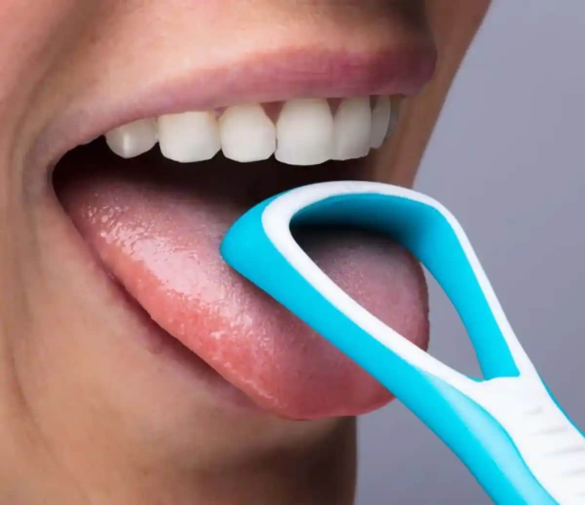 Dil Temizliği ve Ağız Sağlığını Koruma Yöntemleri Sağlıklı Bir Gülüş İçin