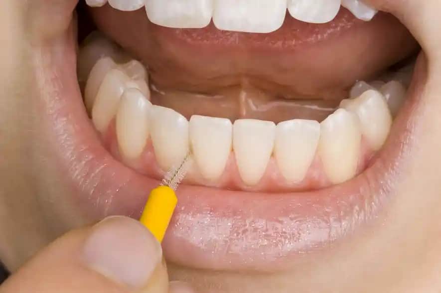 Diş Sağlığını Güçlendiren Interdental Temizlik ve Kozmetik Faydaları