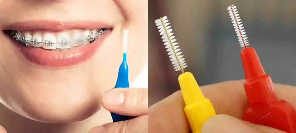 Diş Sağlığını Koruyan Arayüz Fırçası Kullanım Rehberi ve Önemi