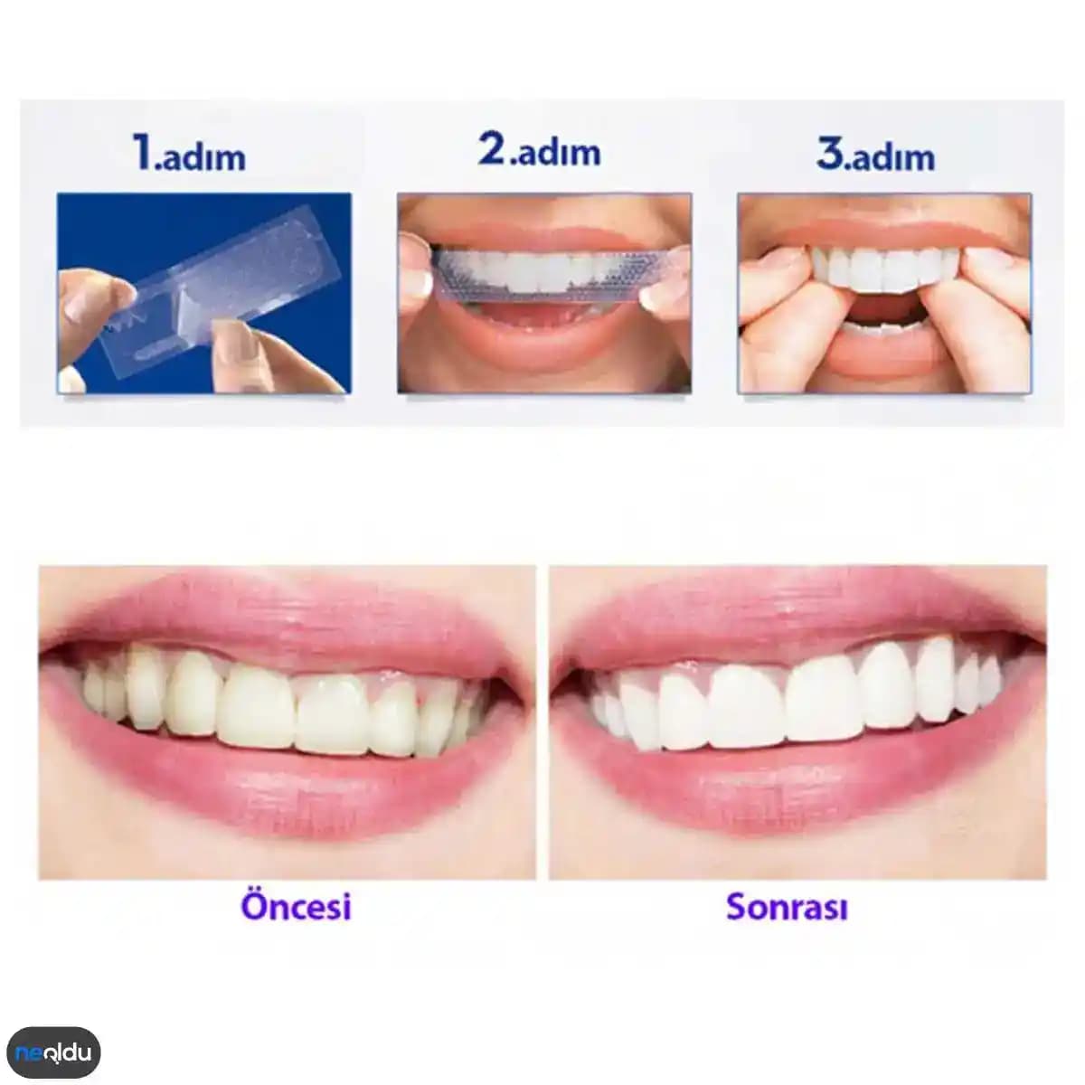 2025'te Diş Beyazlatan Macunlarla Gülüşünüzü Parlatmanın 5 Sırrı