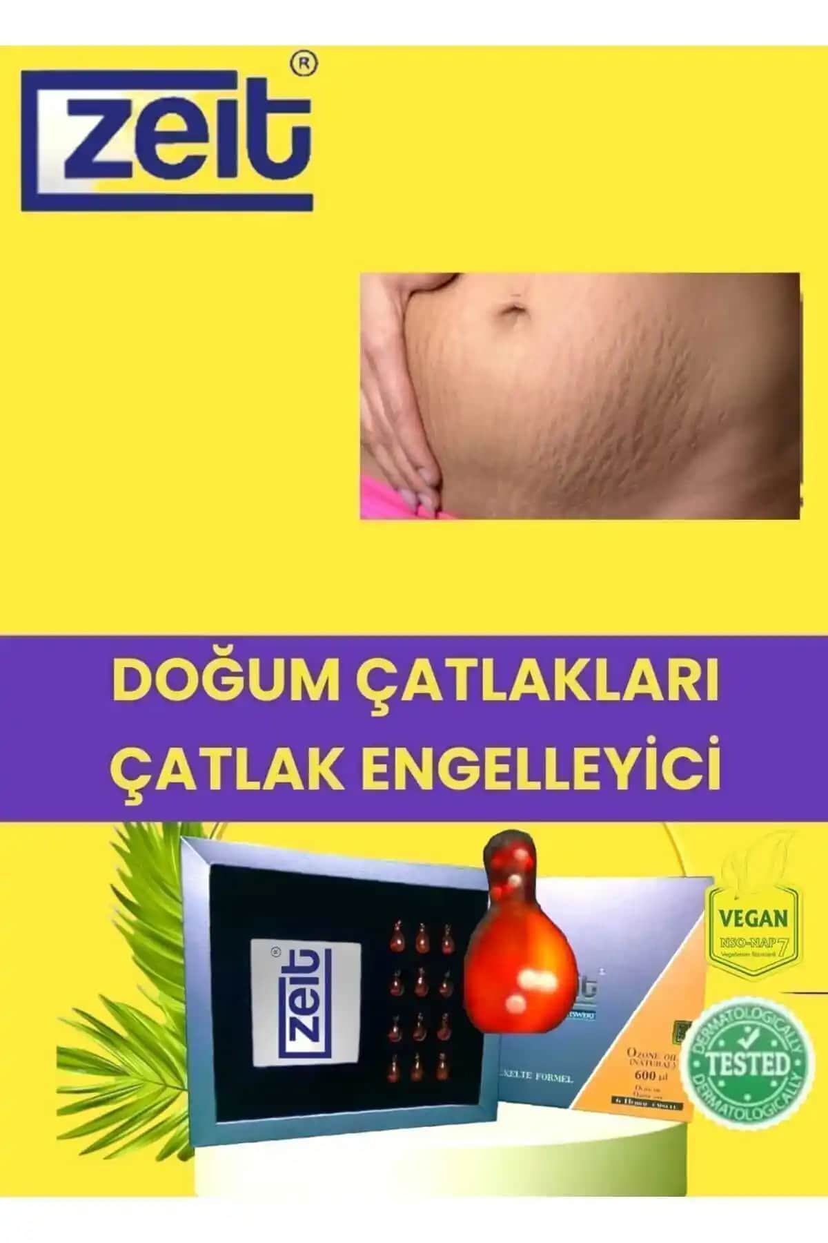 Doğum Çatlakları İçin En Etkili Kremler ve Doğru Uygulama Yöntemleri