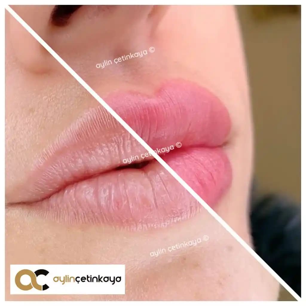Dudak Estetiği ve Bakımı: Güncel Trendler, Ürünler ve Sağlık İpuçları