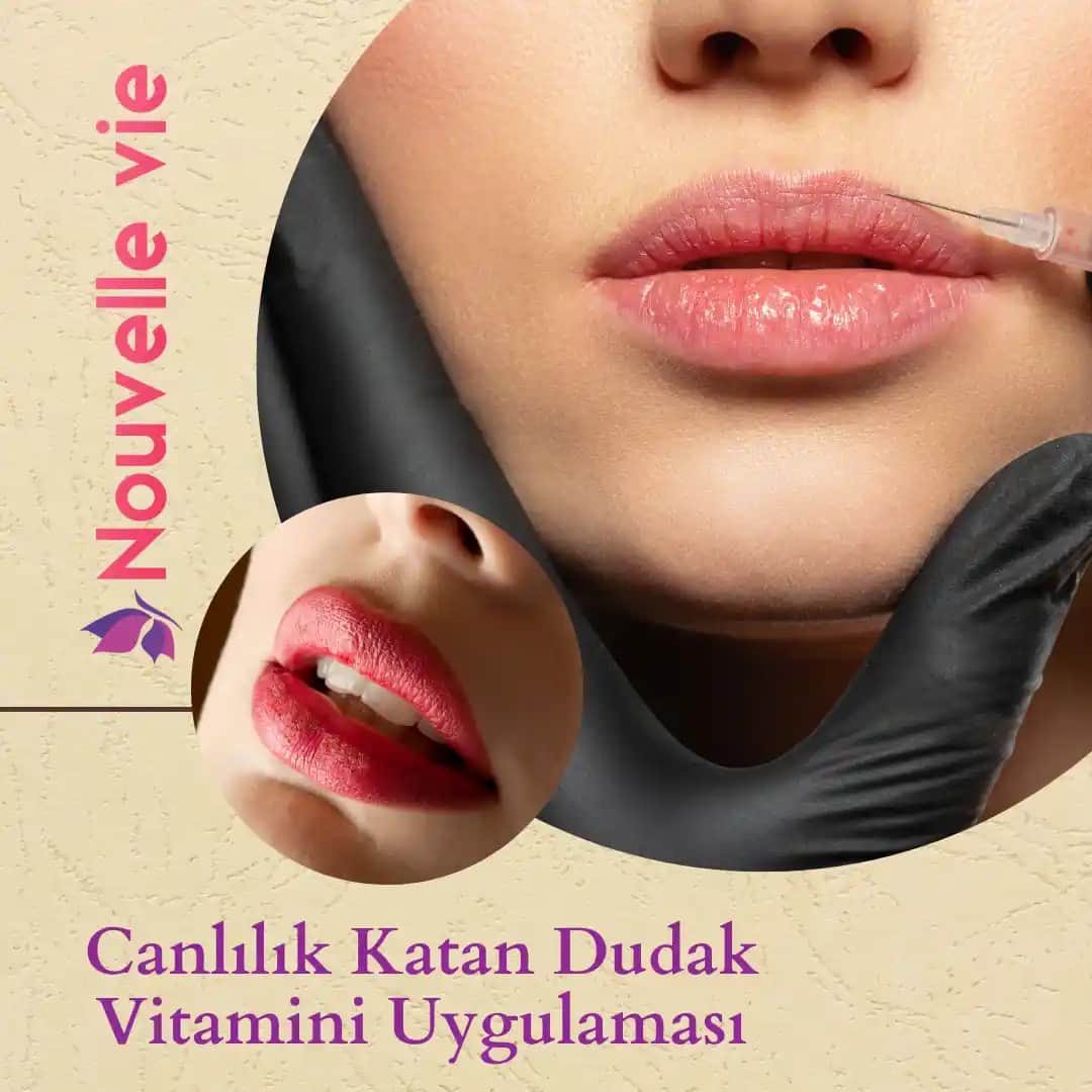 Dudak Vitamini Nedir, Nasıl Uygulanır ve Dudak Sağlığını Nasıl Destekler