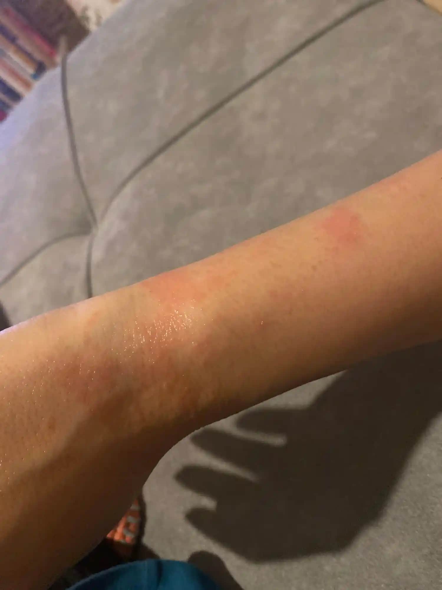 Egzamalı Ciltler İçin Doğru Duş Jeli Seçimi ve Cilt Bakım İpuçları