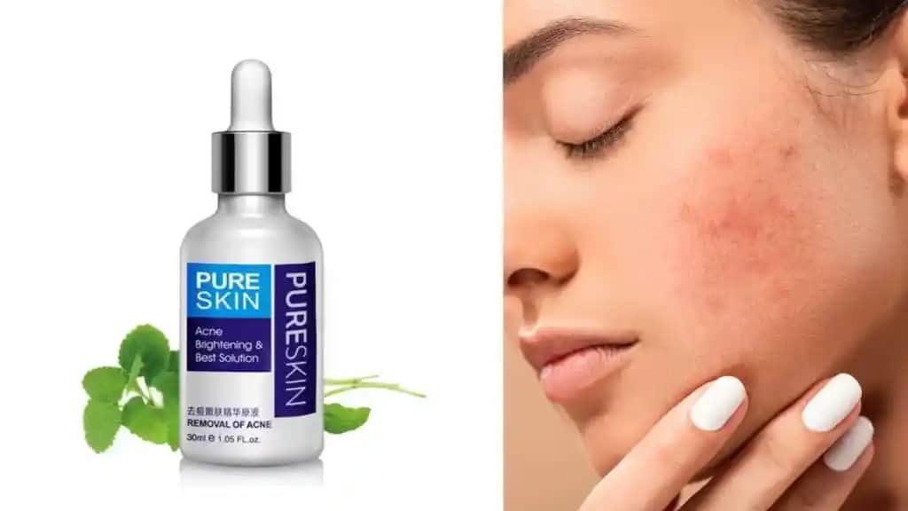 En İyi Sivilce Serumu Seçenekleri ve Cilt Sağlığı İçin Doğru Kullanım Rehberi