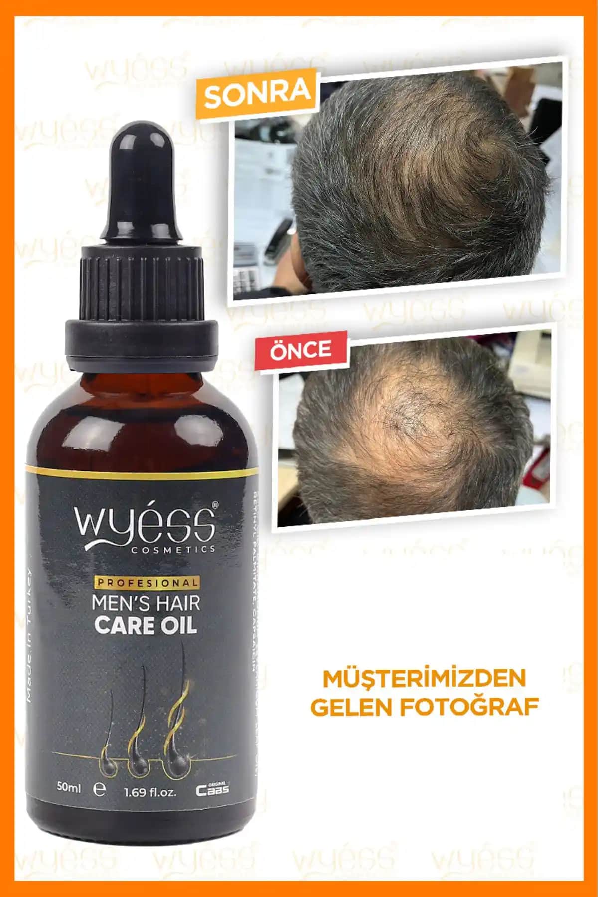 Erkekler İçin Saç Bakımında Saç Bakım Yağı Kullanımının Önemi ve Faydaları