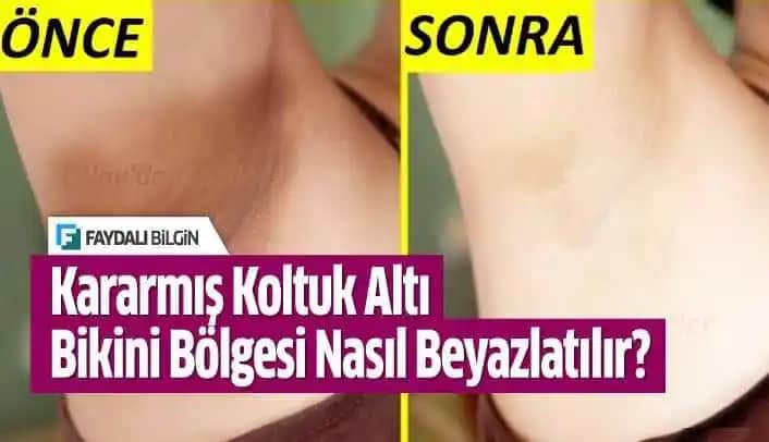 Fa Koltuk Altı Deodorantları: Günlük Hijyen ve Ferahlık İçin Güvenilir Çözümler
