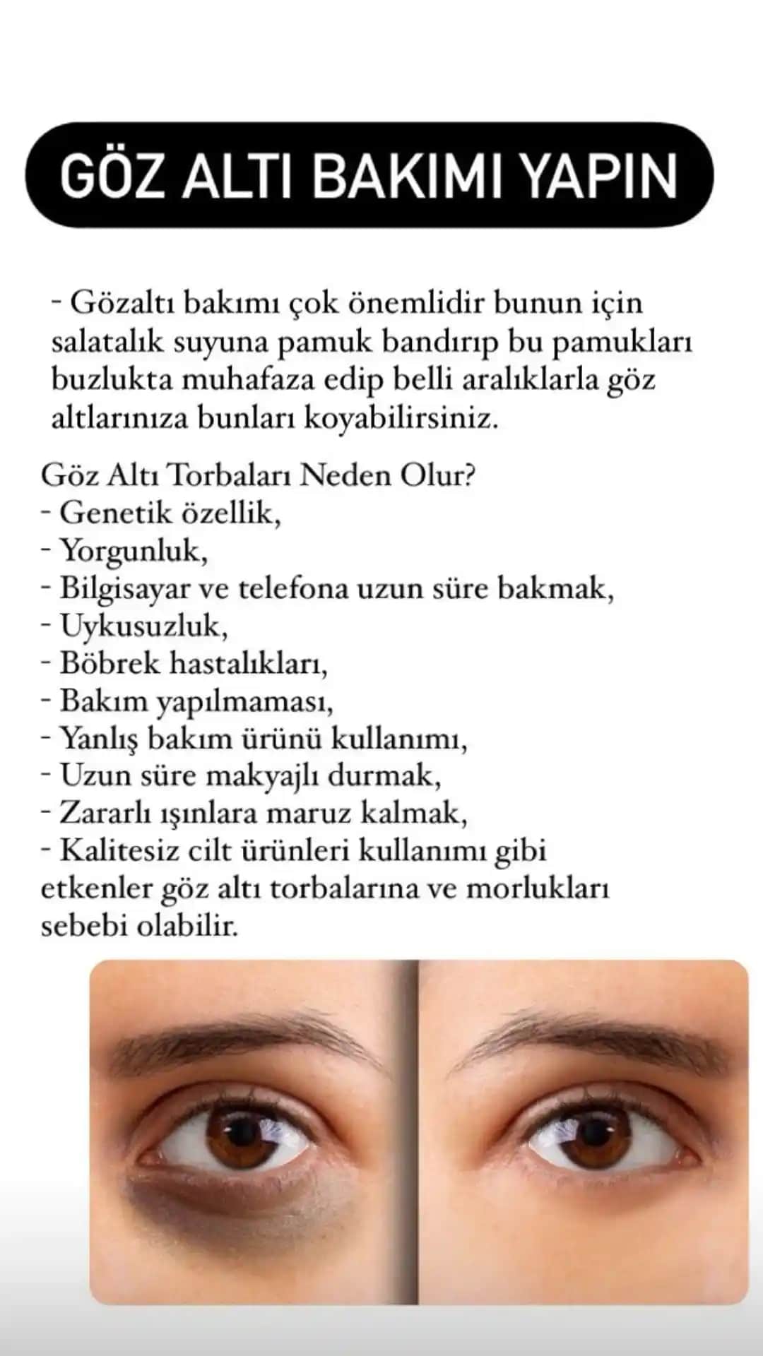 Göz Altı Gözeneklerini Sıkılaştırma ve Yenileme Yöntemleri Hakkında Bilgilendirici Rehber