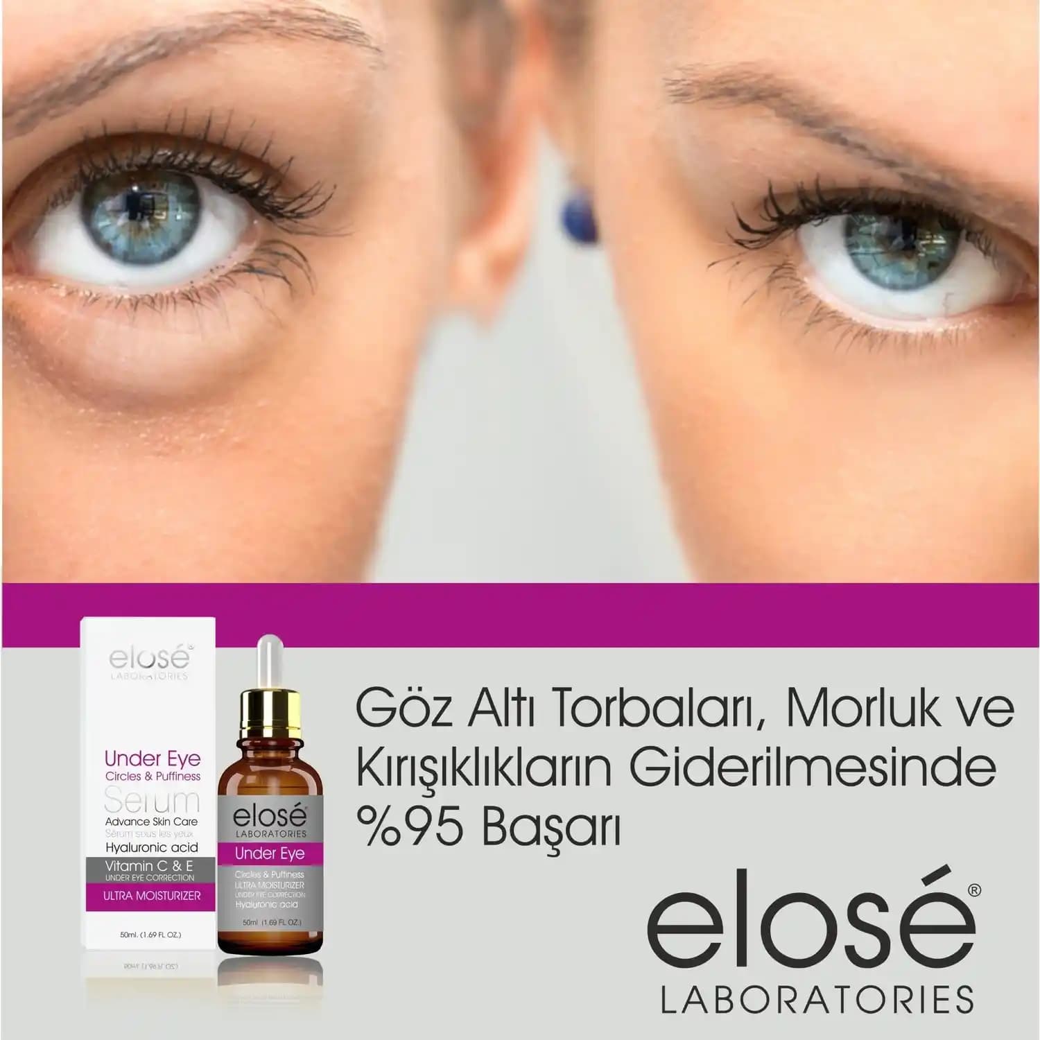 Göz Altı Morluklarına Karşı Etkili Serum Seçenekleri ve Bakım İpuçları