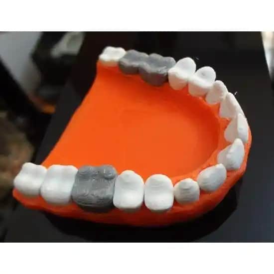 Gümiş Diş Nedir Avantajları ve Dezavantajlarıyla Uzun Ömürlü Kullanım İpuçları