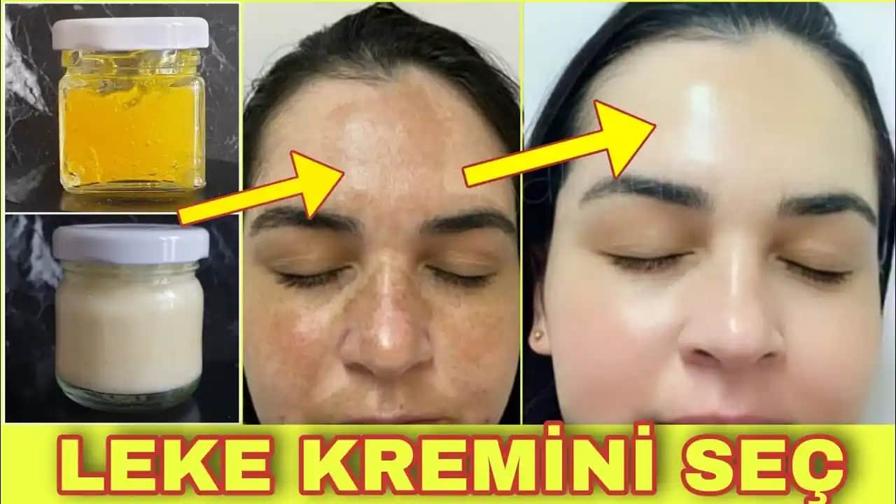 Güneş Lekelerini Hafifletici Kremler ve Cilt Tonu Eşitleme Yöntemleri