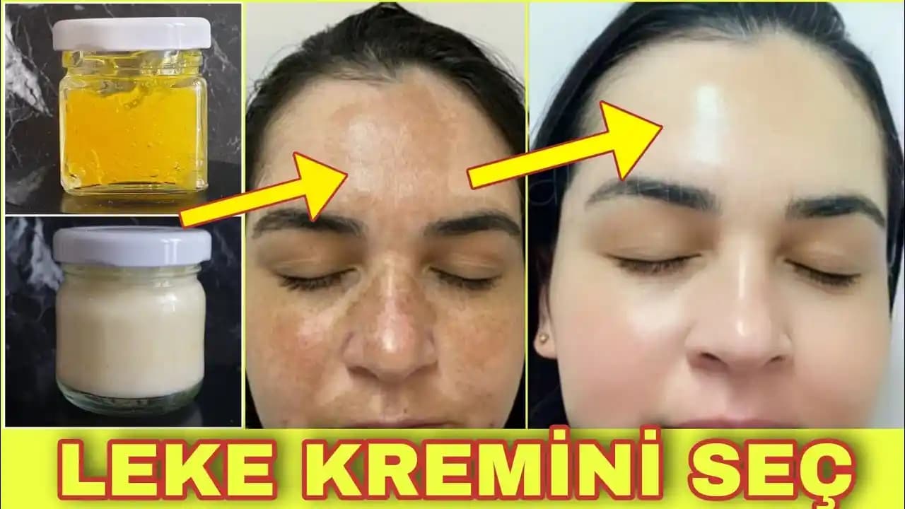 Güneş Lekelerini Hafifletici Kremler ve Cilt Tonu Eşitleme Yöntemleri