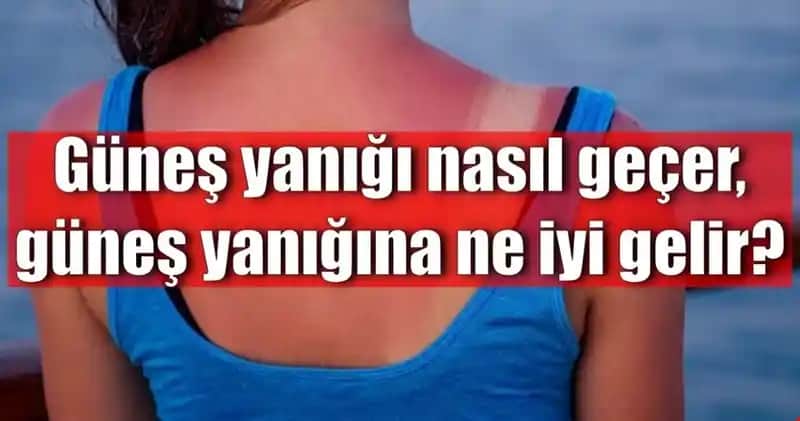 Güneş Yanığına Karşı Doğru Yöntemler ve Korunma İpuçları
