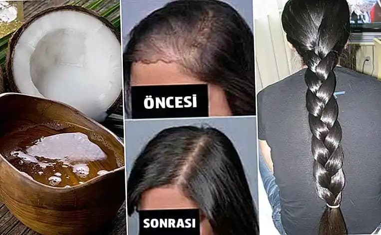 Hindistan Cevizi Yağı ve Saç Dökülmesine Karşı Etkileri: Doğal Bir Çözüm mü?