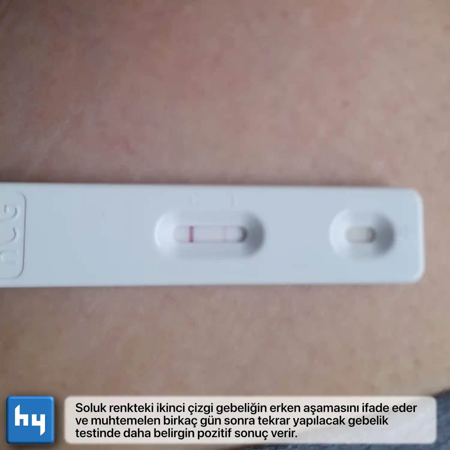 Hızlı Gebelik Testi Nasıl Yapılır ve Güvenilir Sonuçlar İçin İpuçları