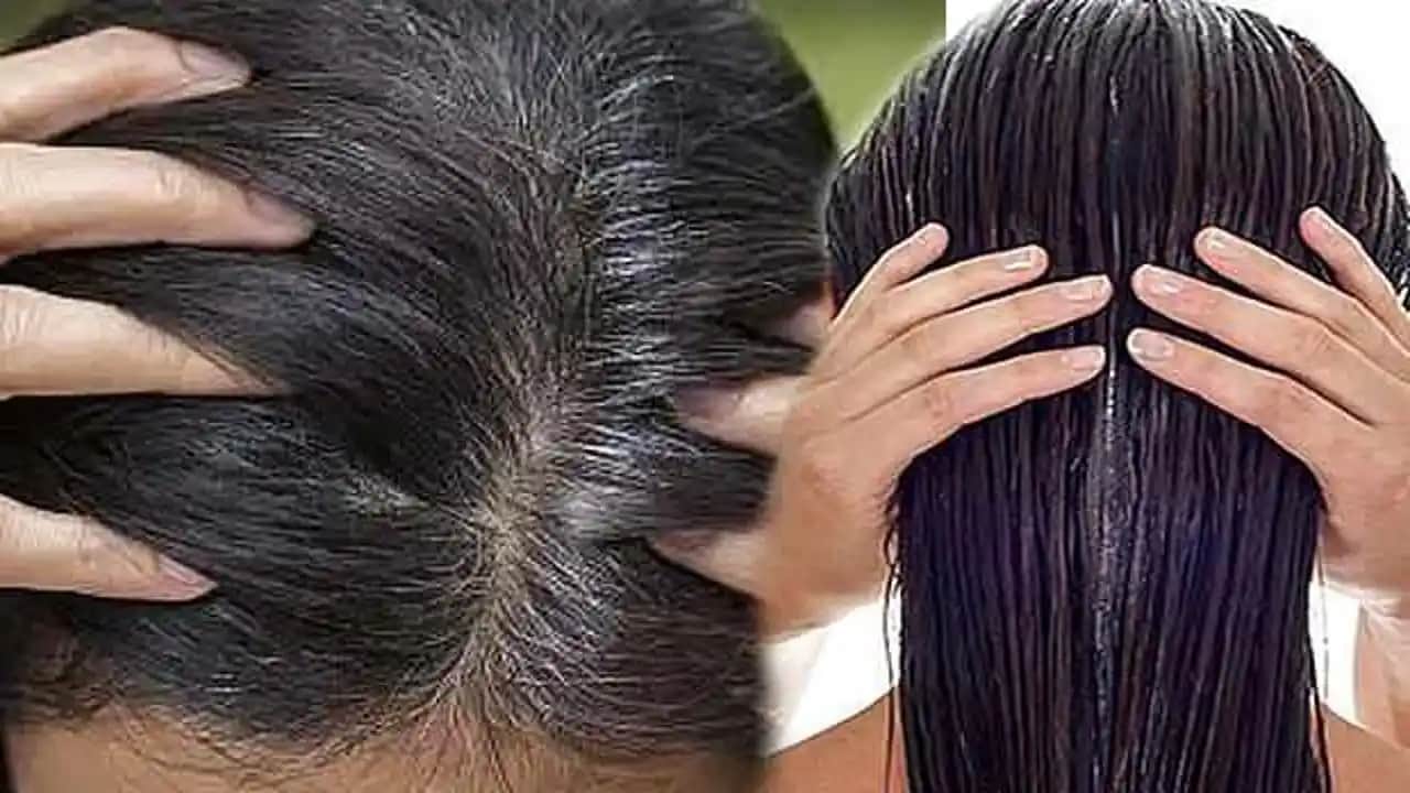 Kabuklu Kepek Nasıl Geçer? Etkili ve Kalıcı Çözüm Yöntemleri