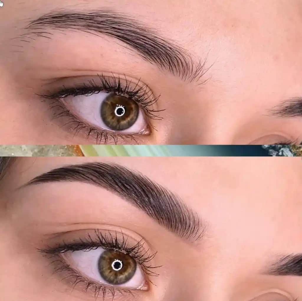 Kaş Laminasyonu Nedir ve Doğal Görünüm İçin Nasıl Uygulanır