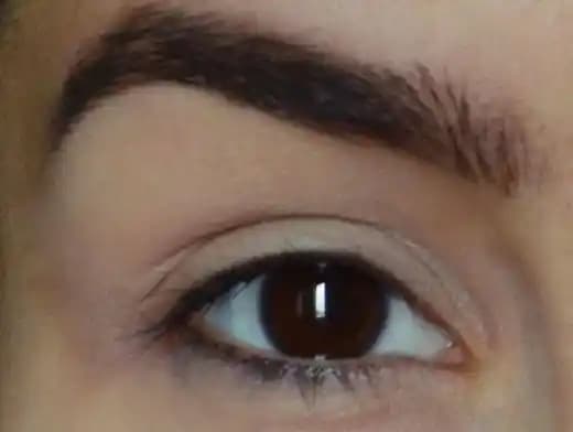 Kaşta Kepek Sorunu ve Çözüm Yolları: Etkili Bakım ve Doğal Yaklaşımlar