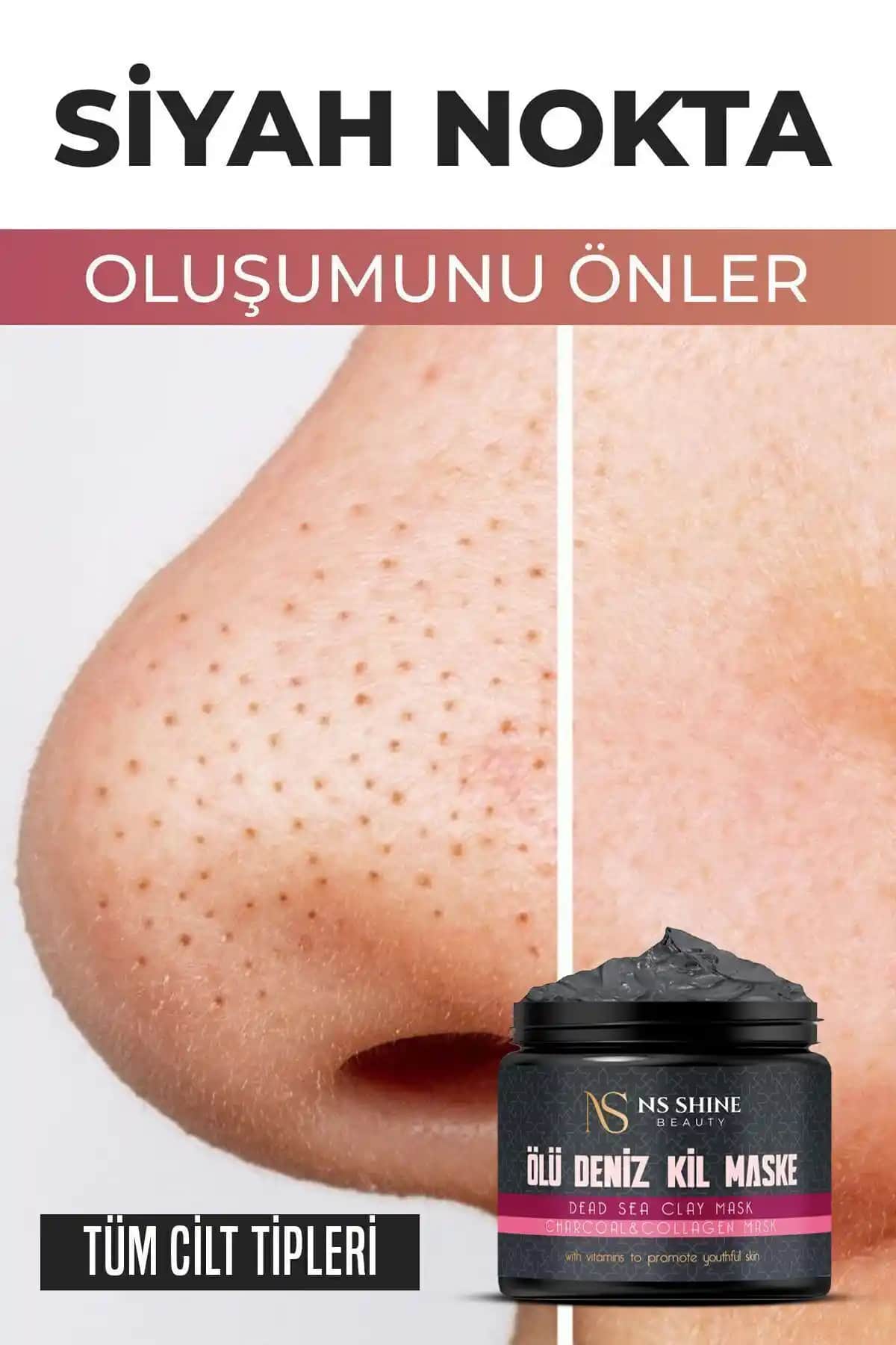 Kil Maskesi ve Siyah Noktalar Üzerindeki Etkisi Cilt Sağlığına Faydaları