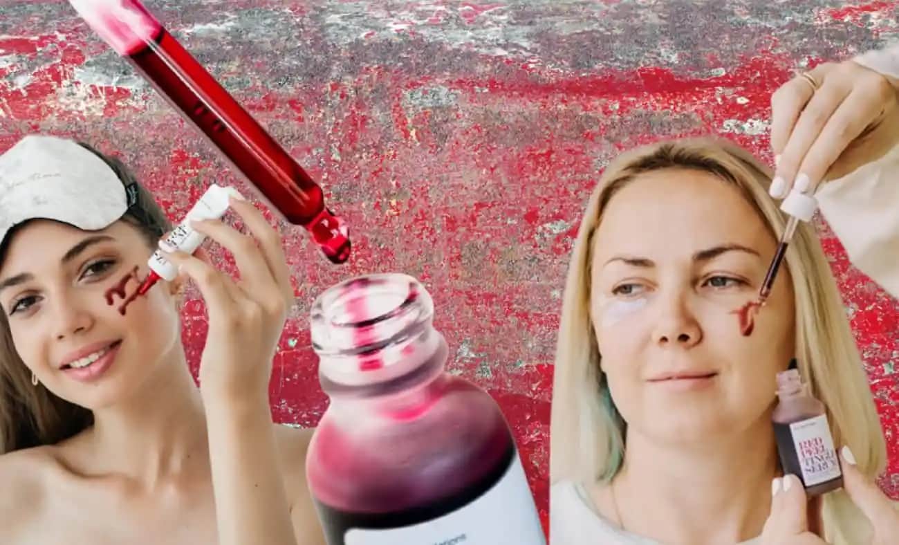 Kırmızı Peeling Nedir ve Cilt Sağlığına Faydaları Nelerdir