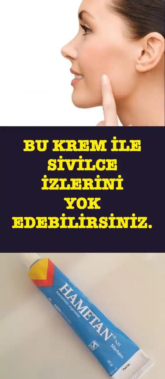 2025'te Kırmızı Sivilce Lekeleriyle Mücadelede Bilmeniz Gereken 5 Sır