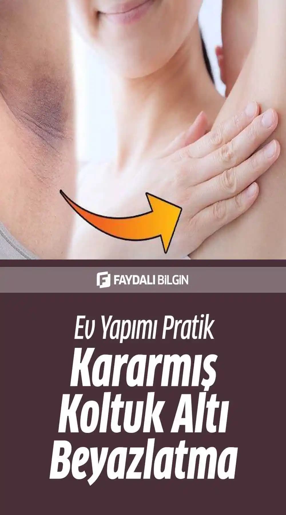 Koltuk Altı Kararması ve Beyazlatma Yöntemleri: Doğal ve Medikal Çözüm Rehberi