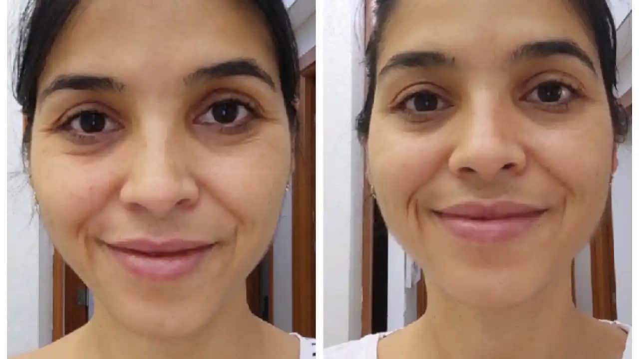 Kozmetik Dünyasında Kolajen Takviyesi Seçimi ve Faydaları Hakkında Kapsamlı Rehber