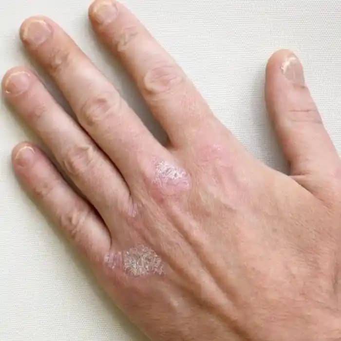 Kuru El Sorunu ve Cilt Sağlığını Koruma Yöntemleri Analizi