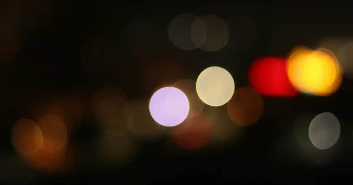 Lazer Epilasyon Rehberi: Güvenli ve Kalıcı Tüy Alma İçin Bilmeniz Gerekenler