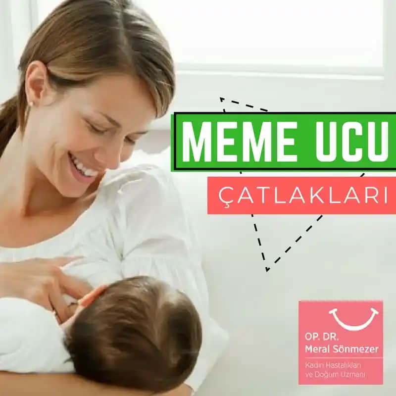 Meme Başındaki Çatlaklar: Nedenleri, Önleme ve Tedavi Yöntemleri