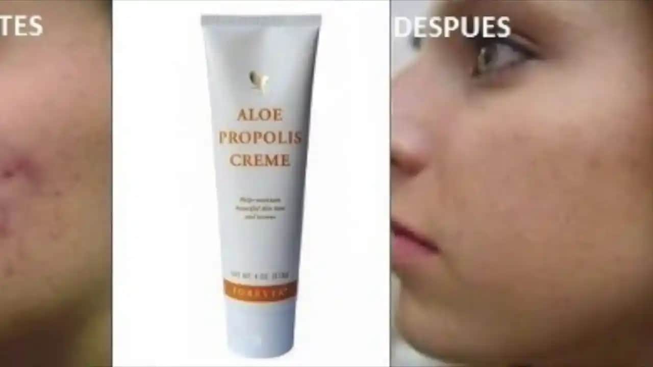 Propolis ve Sivilce: Doğal Çözüm Arayışında Güçlü Bir Alternatif