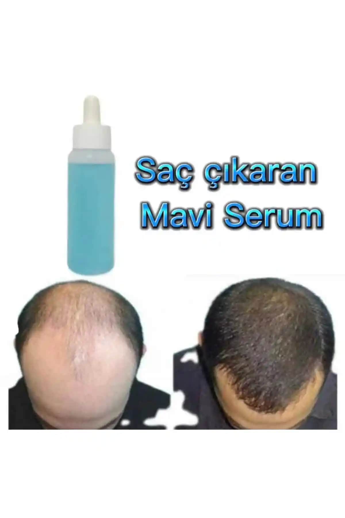 Purest Mavi Serum ile Doğal ve Güçlü Cilt Bakımı Sağlayan En Saf Formül