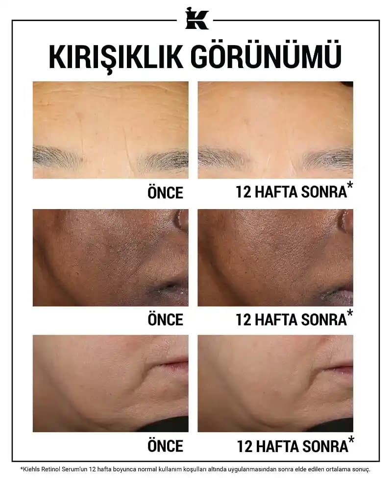 Retinol Nedir ve Cilt Sağlığına Faydaları: Kullanım İpuçları ve Dikkat Edilmesi Gerekenler