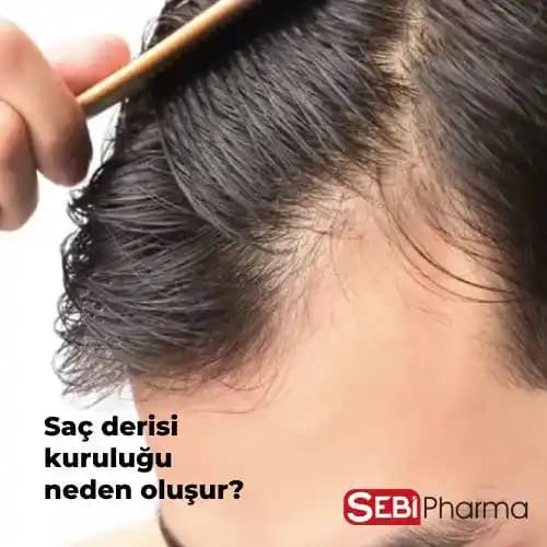 Saç Derisi Kuruluğunu Önlemenin ve Gidermenin Etkili Doğal Yöntemleri