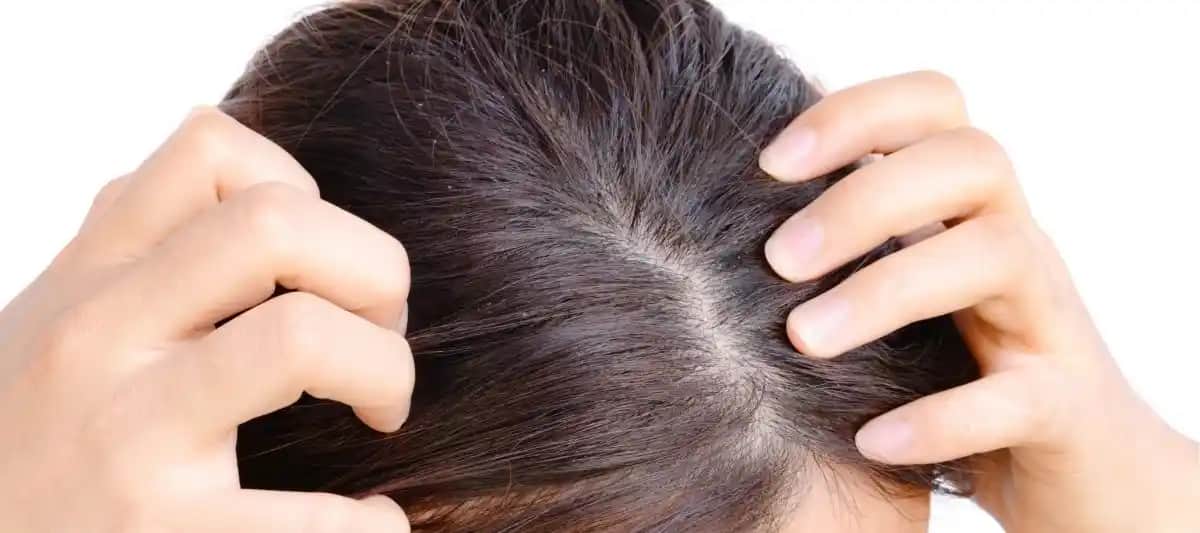 Saç Derisi Sağlığını Koruma ve Güçlendirme Yöntemleri