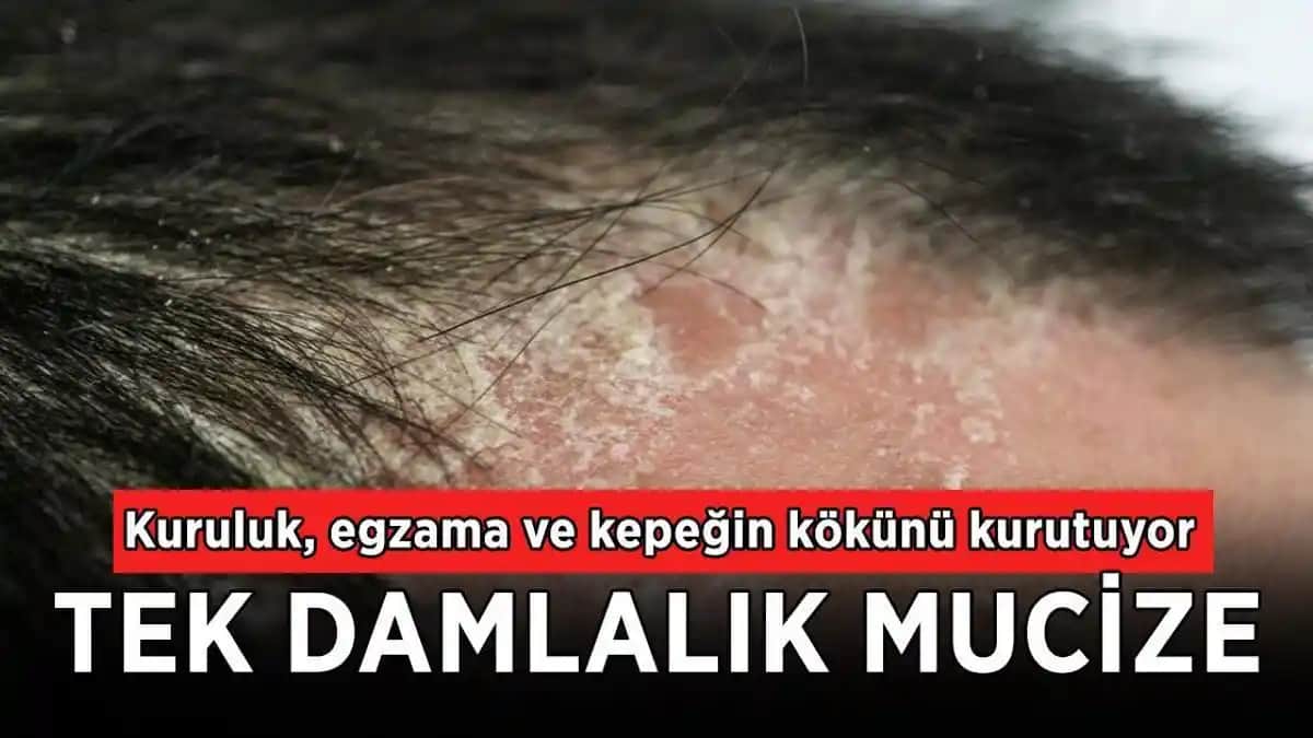 Saç Diplerindeki Kuruluk Nedenleri, Belirtileri ve Etkili Çözüm Yolları