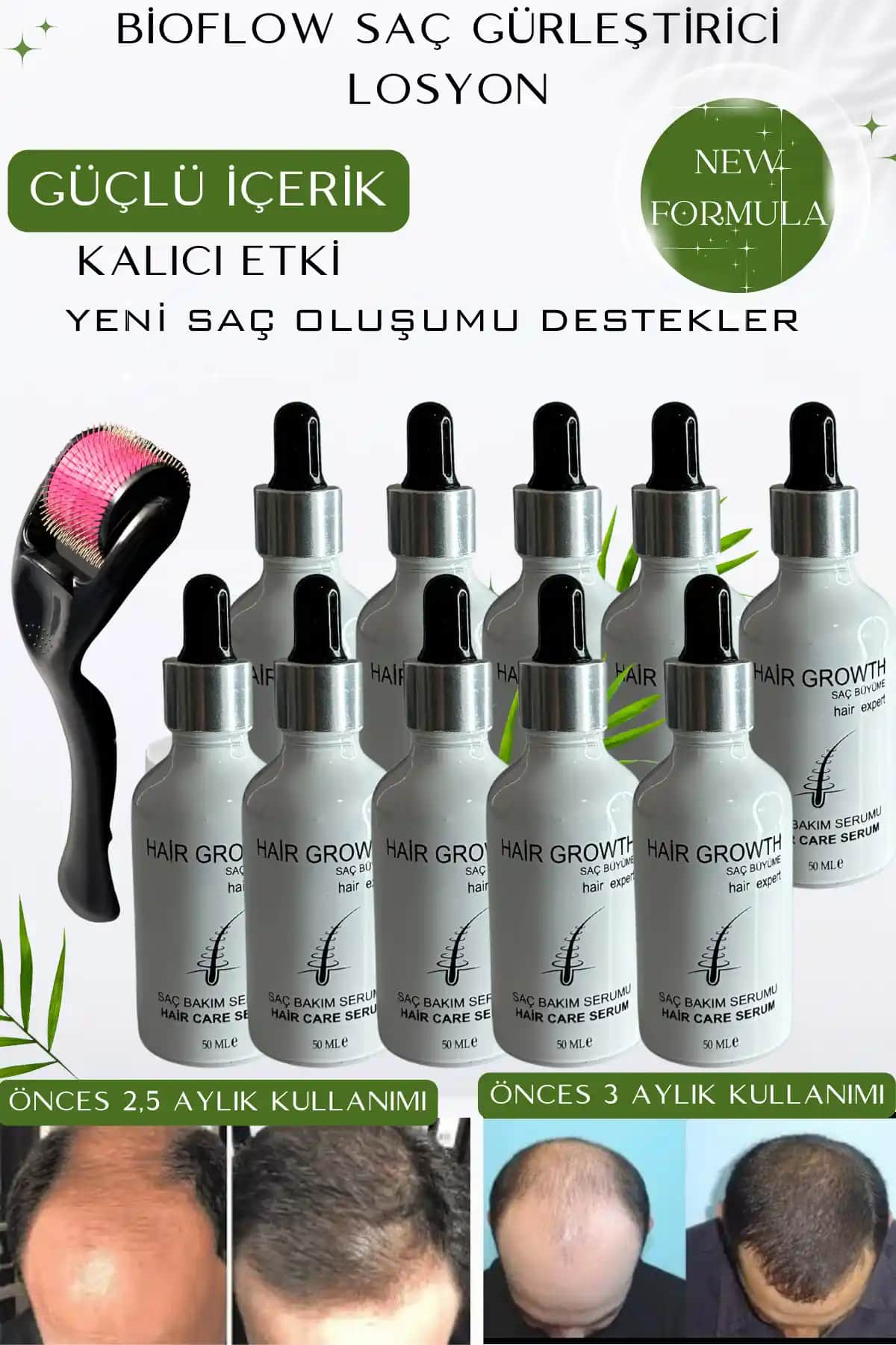 Saç Gürleştirici Ürünler ile Hacimli ve Sağlıklı Saçlara Ulaşmanın Yolları