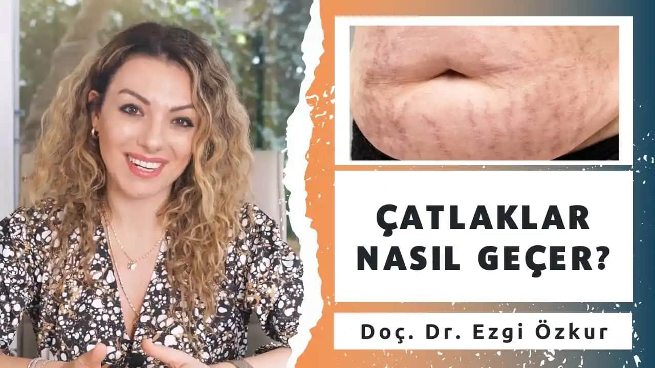 Yeni Oluşan Çatlaklar Nasıl Geçer: Etkili Yöntemler ve Doğal Çözümler