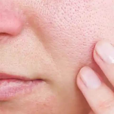 Yüzdeki Gözenekleri Temizleme ve Sıkılaştırma Yöntemleri Rehberi