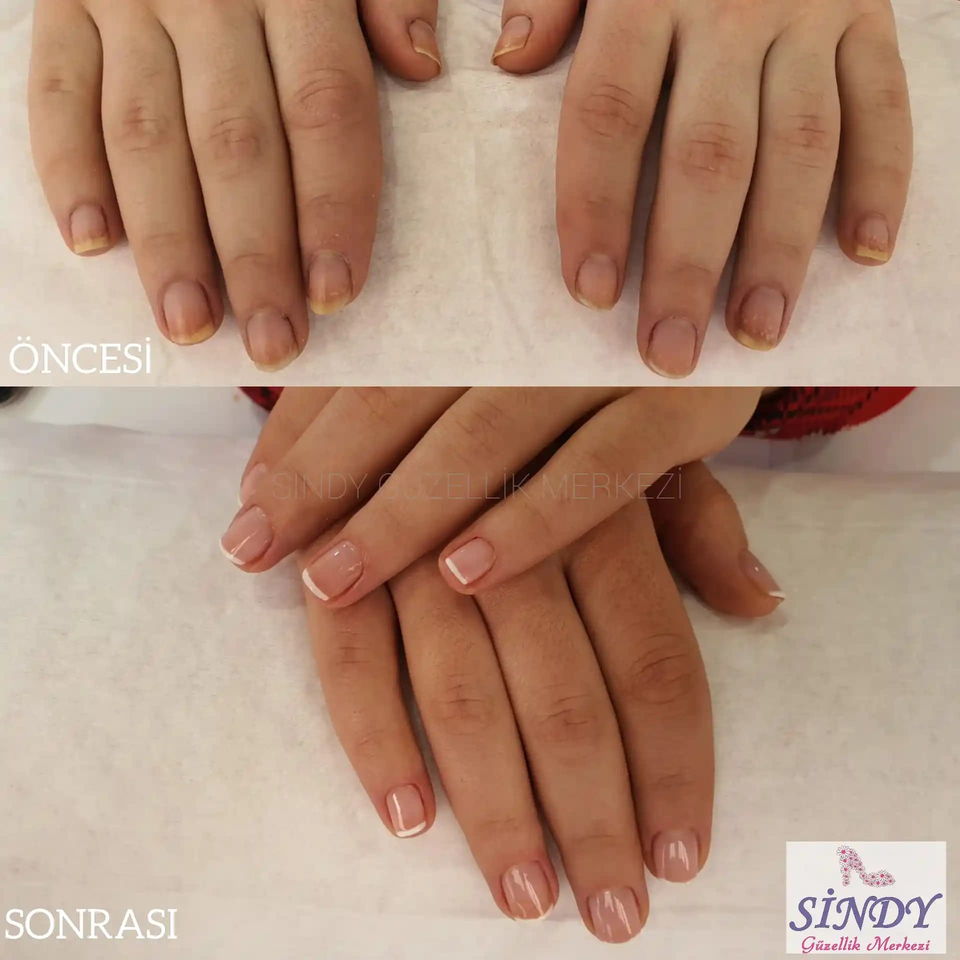 2025'te Manikür ve Pedikür Öncesi ve Sonrası Bakımın 5 Kritik Sırrı