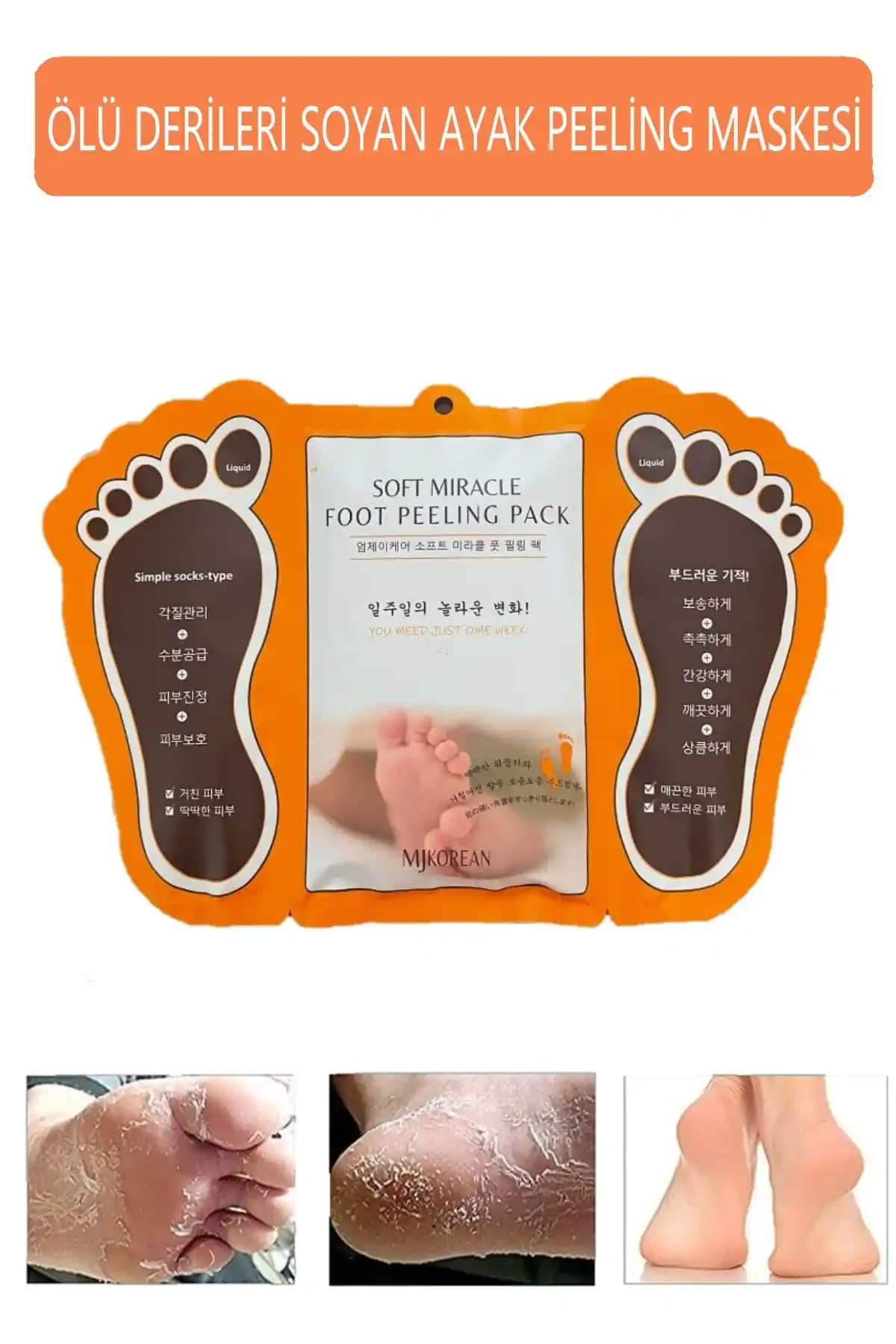 MJKorean Ayak Maskesi İncelemesi: Evde Kolay ve Etkili Ayak Bakımı Çözümü