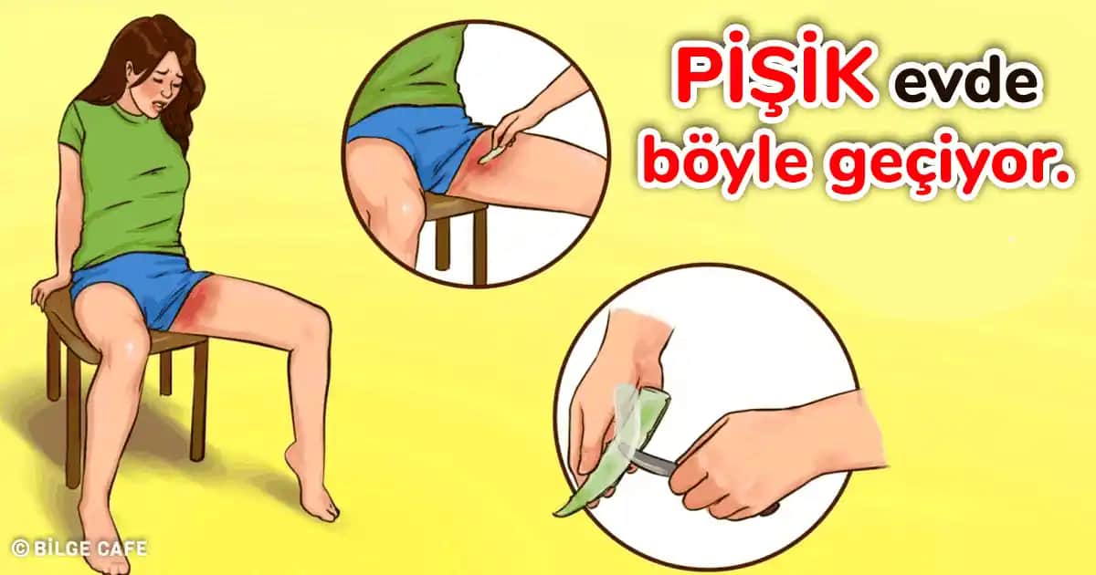 Pişik Sorunu ve Kozmetik Ürünlerle Etkili Mücadele Yöntemleri