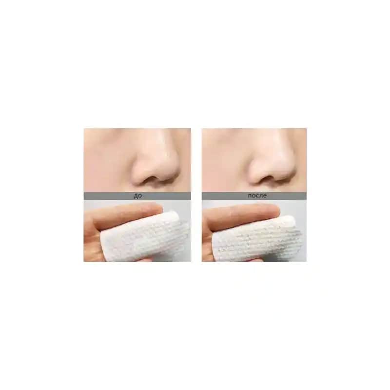 Pore Peeling Büyük Ped Kullanımı ve Cilt Temizliği İpuçları