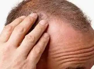 Saç Çıkaran Vitaminler ve Doğru Takviyelerle Sağlıklı Saçlara Kavuşma Rehberi