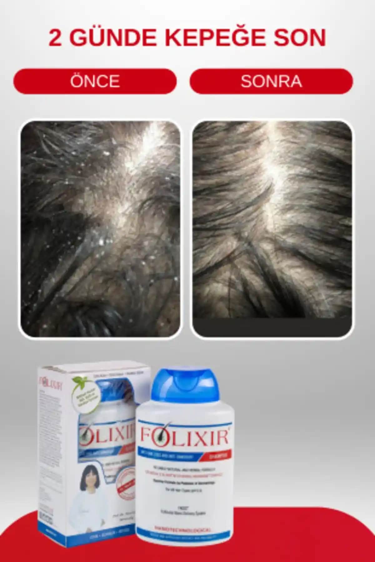 Saç Dökülmesi ve Kepeğe Karşı Etkili Şampuan Seçenekleri ve Doğru Bakım Yöntemleri